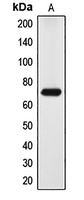 DYRK1A Rabbit Polyclonal Antibody