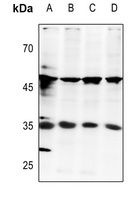 E2F6 Rabbit Polyclonal Antibody