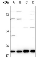 Ephrin A1 Antibody