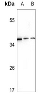 Ephrin A3 Antibody