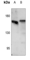 EGFR (Phospho-S1071) Rabbit Polyclonal Antibody