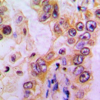 EHHADH Rabbit Polyclonal Antibody