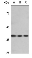 EIF2S1 (Phospho-S51) Rabbit Polyclonal Antibody