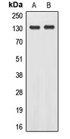 EPHA2 (Phospho-Y588) Rabbit Polyclonal Antibody