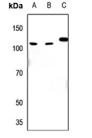 EIF4G2 Rabbit Polyclonal Antibody