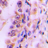 EIF4G2 Rabbit Polyclonal Antibody