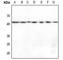 Gamma-enolase Rabbit Polyclonal Antibody
