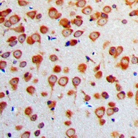 Gamma-enolase Rabbit Polyclonal Antibody