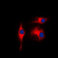 Gamma-enolase Rabbit Polyclonal Antibody