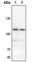 EPHA3 Rabbit Polyclonal Antibody