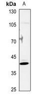 NR2F6 Rabbit Polyclonal Antibody