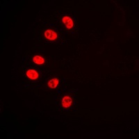 NR2F6 Rabbit Polyclonal Antibody