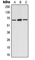 Estrogen Receptor alpha (Phospho-Y537) Rabbit Polyclonal Antibody