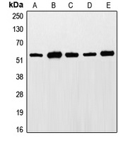 ETS1 (Phospho-T38) Rabbit Polyclonal Antibody