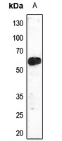 TEL Rabbit Polyclonal Antibody