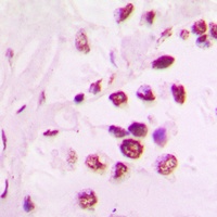 TEL Rabbit Polyclonal Antibody