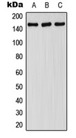 FANCA (Phospho-S1149) Antibody