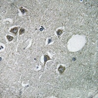 Fibulin 2 Rabbit Polyclonal Antibody