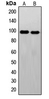 c-FER Rabbit Polyclonal Antibody
