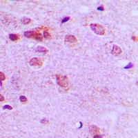 c-FER Rabbit Polyclonal Antibody