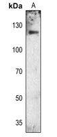 FGFR1 (Phospho-Y654) Rabbit Polyclonal Antibody