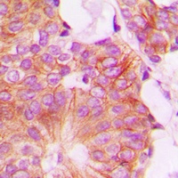 FHIT Rabbit Polyclonal Antibody