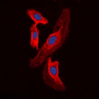 FHIT Rabbit Polyclonal Antibody