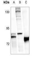 FOXO1 (Phospho-S319) Rabbit Polyclonal Antibody