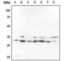 FRA2 Rabbit Polyclonal Antibody
