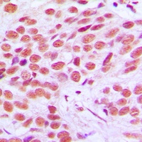 FRA2 Rabbit Polyclonal Antibody