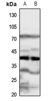 FPR1 Rabbit Polyclonal Antibody