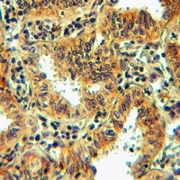 FPR1 Rabbit Polyclonal Antibody