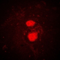 FRK Rabbit Polyclonal Antibody