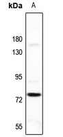 FSHR Rabbit Polyclonal Antibody