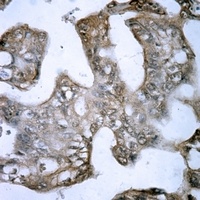 FSHR Rabbit Polyclonal Antibody