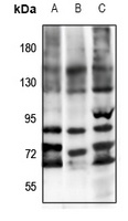 FSHR Rabbit Polyclonal Antibody