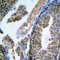FSHR Rabbit Polyclonal Antibody