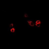 FSHR Rabbit Polyclonal Antibody