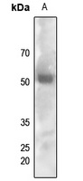 FYN (Phospho-Y530) Rabbit Polyclonal Antibody
