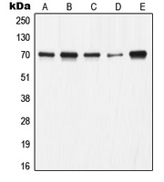 Ku70 Antibody [KO/KD Validated]
