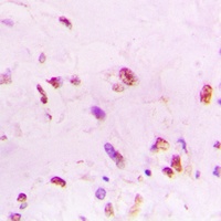 Ku70 Antibody [KO/KD Validated]