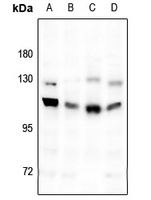 GABBR1 Rabbit Polyclonal Antibody