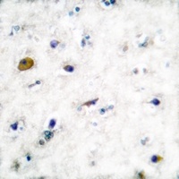 GABBR1 Rabbit Polyclonal Antibody