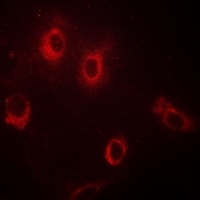 GAD1/2 Rabbit Polyclonal Antibody