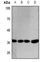 GAPDH Rabbit Polyclonal Antibody