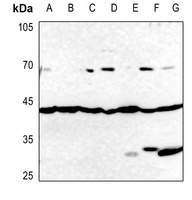 GATA4 Rabbit Polyclonal Antibody