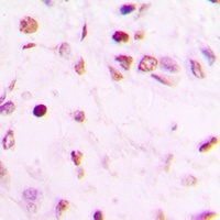 GATA4 Rabbit Polyclonal Antibody