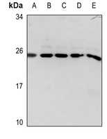 Glucagon Rabbit Polyclonal Antibody