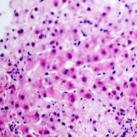 Glucagon Rabbit Polyclonal Antibody