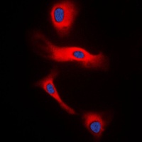 Glucagon Rabbit Polyclonal Antibody
